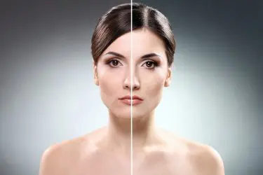Dermal Fillers and Injectables in Columbia, SC